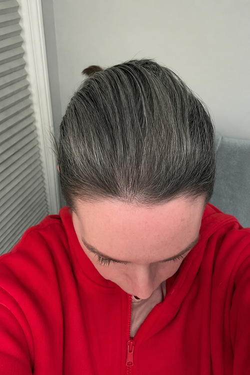 Cheveux préservés à temps