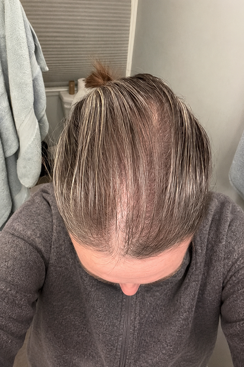 Cheveux préservés à temps