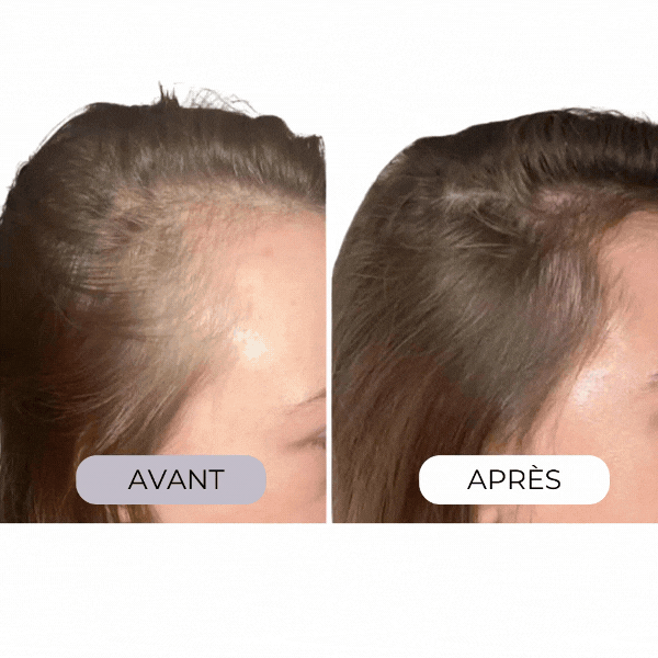 Micro-infusion capillaire régénérante Colagea®