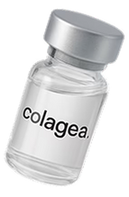 Compare Table Colagea