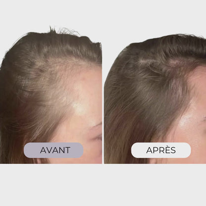 Micro-infusion capillaire régénérante Colagea®